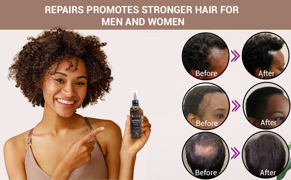 Caffeine Hair Growth Oil 4oz - Hair Growth Oil For Thinning, Balding