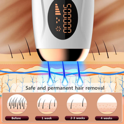 Portable IPL Laser Epilator 999999 Flashes - Painless, Permanent Hair