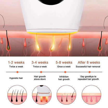 10  Beauty Care IPL Hair Removal Device 990000 Flashes Painless