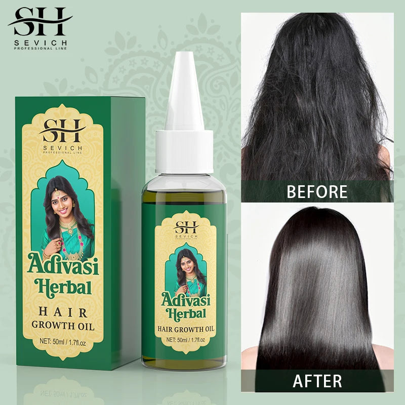 Ayurvedic Hair Growth Oil India Adivasi Organic Hair Growth Serum Anti