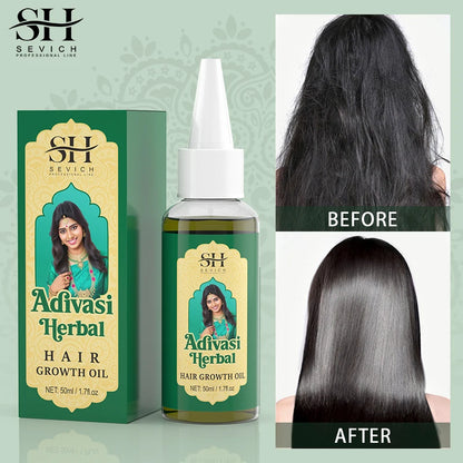 Ayurvedic Hair Growth Oil India Adivasi Organic Hair Growth Serum Anti