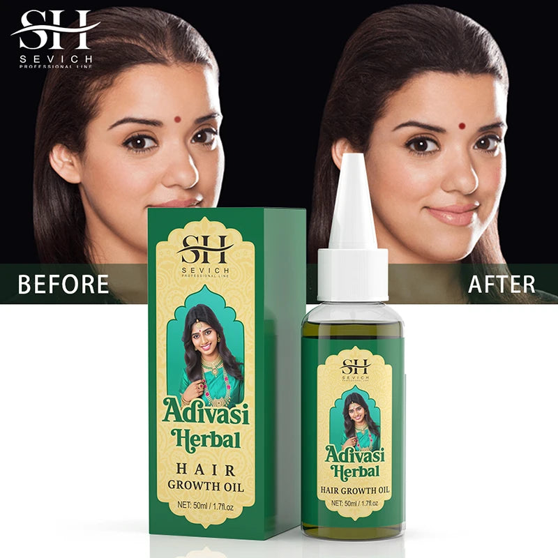 Ayurvedic Hair Growth Oil India Adivasi Organic Hair Growth Serum Anti