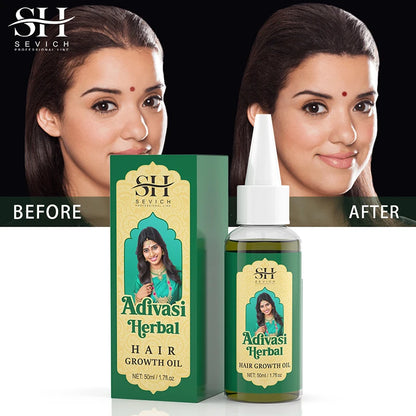 Ayurvedic Hair Growth Oil India Adivasi Organic Hair Growth Serum Anti